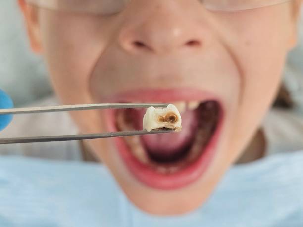 Best Mobile Emergency Dentist in Lowesville, NC